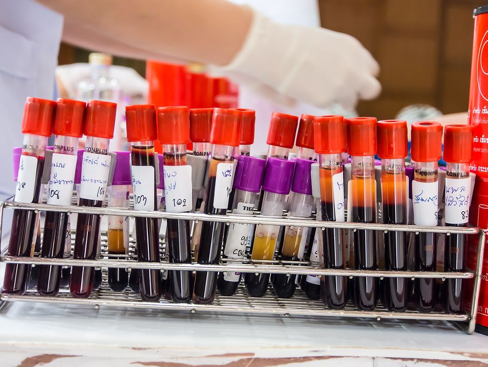 Rett hjem: Det norske firmaet tilbyr kundene å få svar på blodprøvene i posten. 