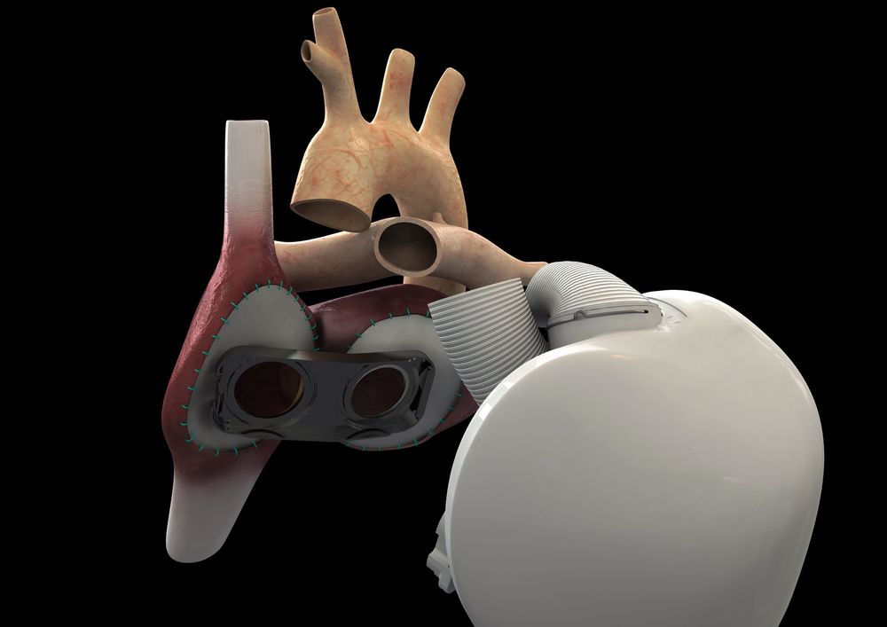 Rammeverket av hjertet er skissert for å vise hvordan blodårene går. "Hullene" viser de to hovedårene  til hjertet.