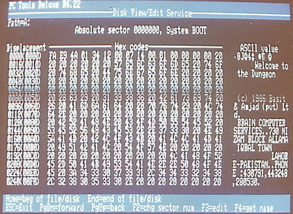 Viruset inneholdt både navn og nummer til programmererne som sto bak.