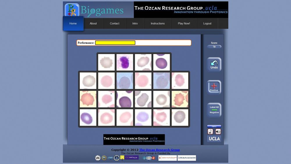 DIAGNOSE: I dette spillet får du poeng for å luke ut malariapositive celler.