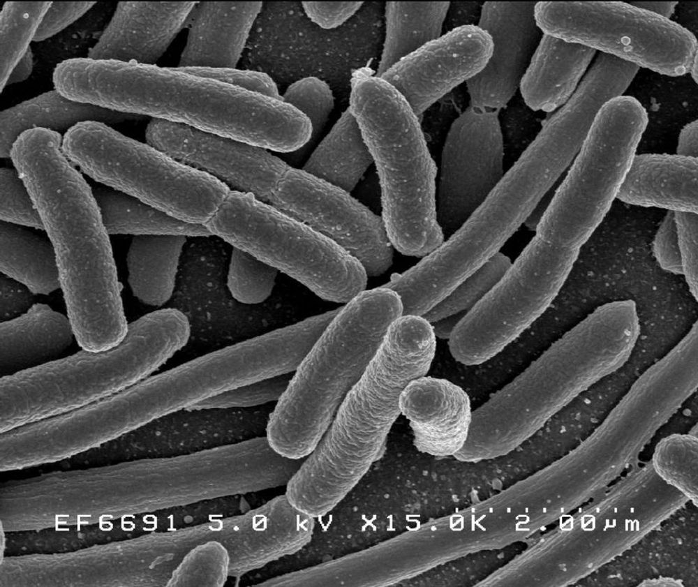 E-coli-bakterier kan snart tas knekken på av komponenter man finner i LCD-skjermer.