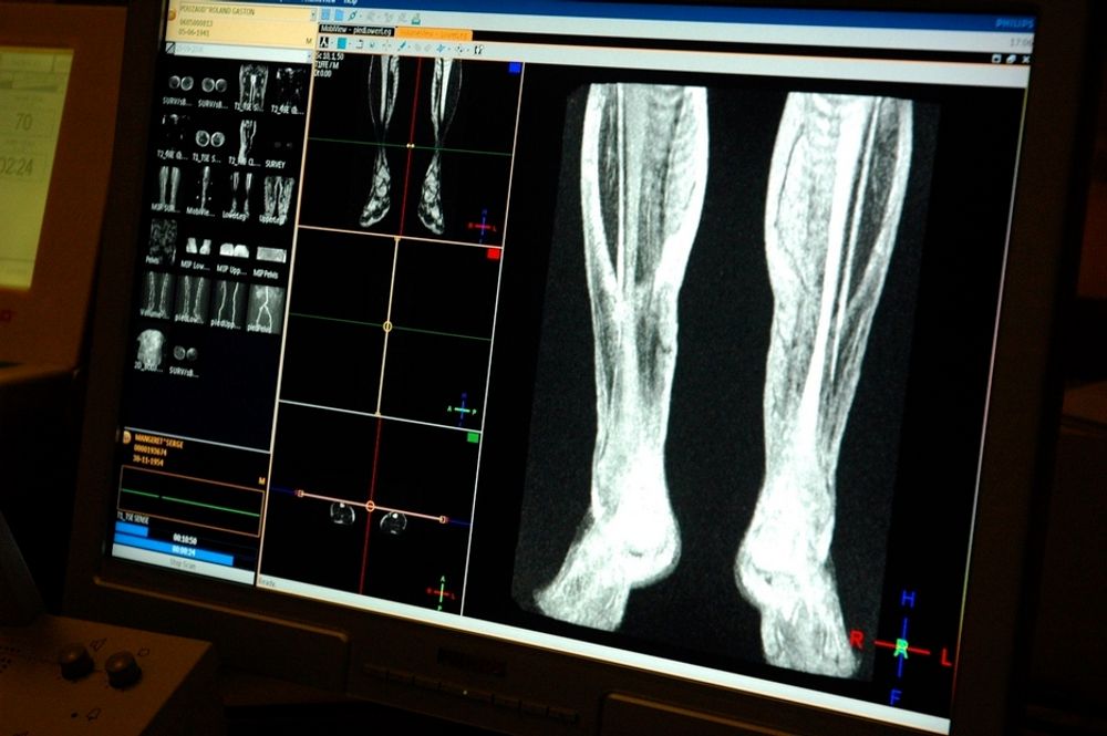 Samles. Digitale pasientjournaler og røntgenbilder i ett system skal øke effektiviteten ved norske sykehus.
