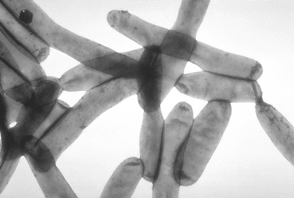 NYE TYPER: Forskerne har identifisert flere nye bakteriestammer som ligner den allerede fryktede legionella pneumophila (bildet).
