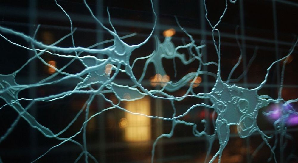 Nerveceller kan dyrkes fram utenfor hjernern. Det kan hjelpe slagpasienter i framtida.