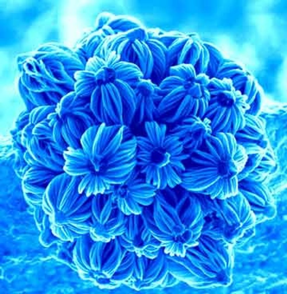Nye materialer utviklet med nanoteknologi framstår som rene blomsterbuketter. Forsker Wei Ho har ikke bare funnet fram til materiealene, hun fotograferer dem jevnlig og presenterer dem son nanobuketter. Foto: Wei Ho
Det er gjennom dette arbeidet hun har kommet over de blomsterlignende strukturene.