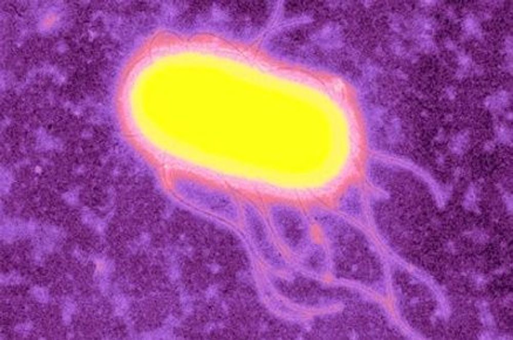 LIMER: Når ekle bakterier f.eks. av type E. coli fester seg - helt uønsket - til kroppens celler, gjør de det med en spesiell type proteiner. Samtidig lurer de den stakkars cellen til å tro at de har lov til å feste seg der. FOTO: IMPERIAL COLLEGE
