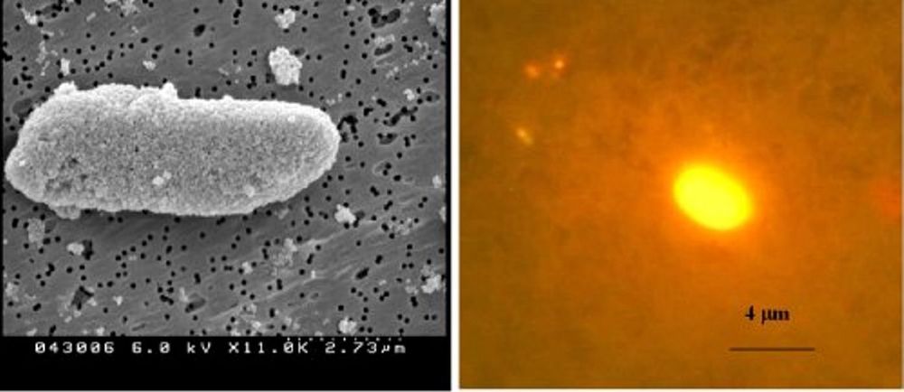 AVSLØRT:En E.coli-bakterie er overstrødd med partikler (t.v). Når nanopartiklene med  tusenvis av fluorescerende fargemolekyler hekter seg på antigenene, lyser de opp. Bakterien blir lett å finne.Foto Nanotechweb.org/Professor Weihong Tan, University of Florida, Gainesville, Florida, US