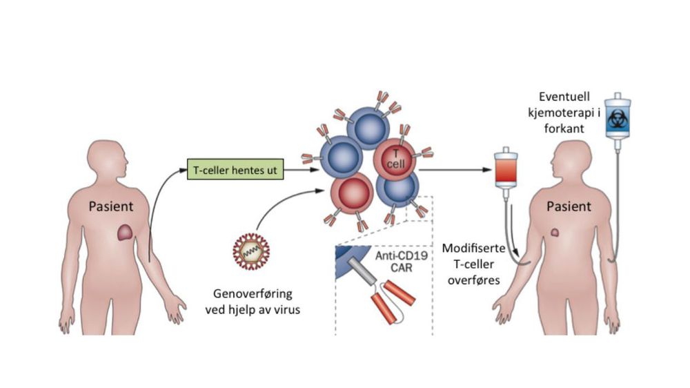 CAR-terapi: Med denne varianten av immunterapi henter man ut immunceller og gir dem nye egenskaper baser på genetisk modifikasjon. Immuncellene dyrkes opp på utsiden av pasienten og når man har nok settes de modifiserte cellene, som kan spore opp og drepe kreftceller, tilbake i blodet.