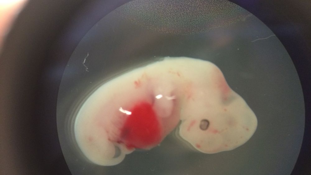 Kimærforskningen bryter hele tiden nye grenser. Her er et fire uker gammelt grisefoster som har blitt injisert med menneskelige stamceller, som utvikler seg.