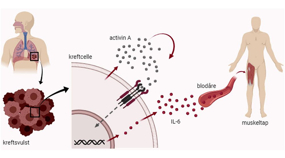 Figuren viser hvordan kreftcellene bruker både activin A og interleukin 6 som signalstoffer som til sist fører til at musklene spiser seg selv.