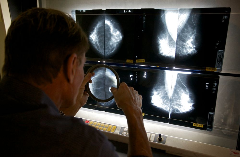 En radiolog undersøker bilder tatt ved mammografi i Los Angeles i USA.