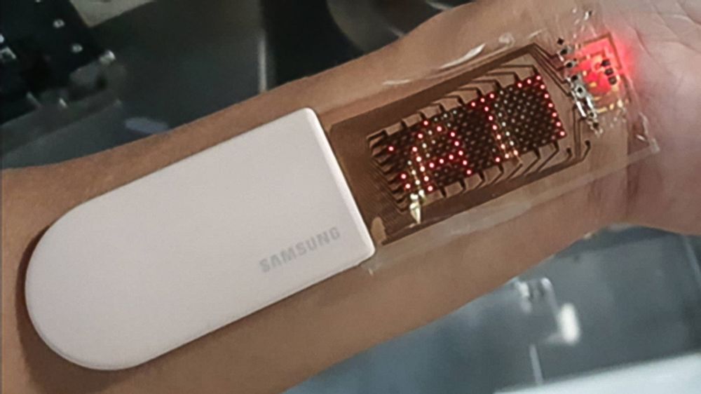 Dette er en prototyp, men Samsung vil jobbe videre med sensorer og skjermer som kan limes på huden. Det gir stor nøyaktighet og lange måleserier og kan bety et nytt nivå i helseovervåkning.