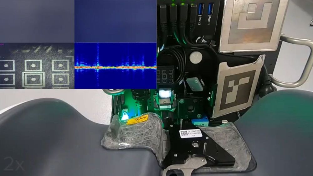 Neuralink skal trolig snart starte testingen av teknologien på mennesker. Bildet viser roboten som skal brukes til å operere inn trådene i hjernen ved hjelp av avanserte sensor- og kamerasystemer.