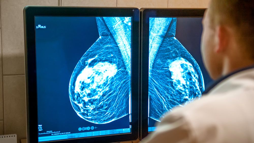 En lege studerer mammografi-bilder.