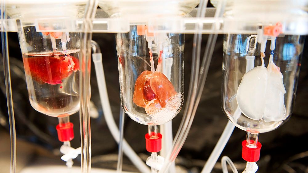 Tømmes for celler: For å lage noe så komplekst som et hjerte trengs det en mal. Dette hjertet fra en rotte blir tømt for levende celler slik at det bindevevet som er igjen kan brukes som en mal for nye stamceller fra individet som trenger hjertet. ⇥Foto: Stefan Zimmerman