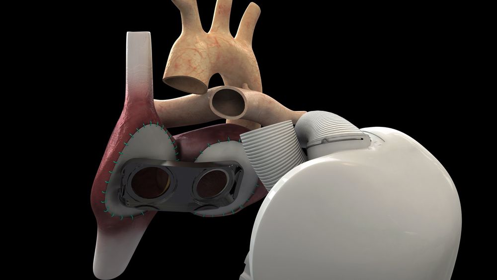 Rammeverket av hjertet er skissert for å vise hvordan blodårene går. "Hullene" viser de to hovedårene  til hjertet.