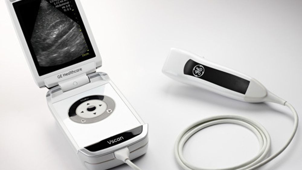 MED I FORSKNINGSSENTER: Bedriften bak det Apple-inspirerte ultralydapparatet Vscan er med som bedriftspartner i et av de nye SFI'ene som Forskningsrådet vil støtte.