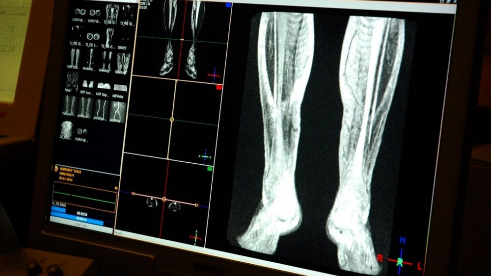Samles. Digitale pasientjournaler og røntgenbilder i ett system skal øke effektiviteten ved norske sykehus.