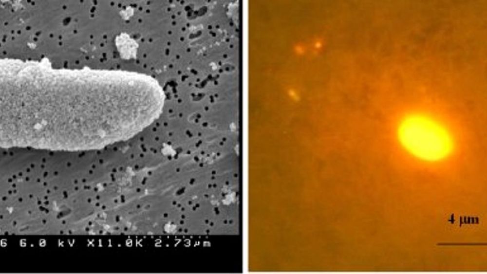 AVSLØRT:En E.coli-bakterie er overstrødd med partikler (t.v). Når nanopartiklene med  tusenvis av fluorescerende fargemolekyler hekter seg på antigenene, lyser de opp. Bakterien blir lett å finne.Foto Nanotechweb.org/Professor Weihong Tan, University of Florida, Gainesville, Florida, US