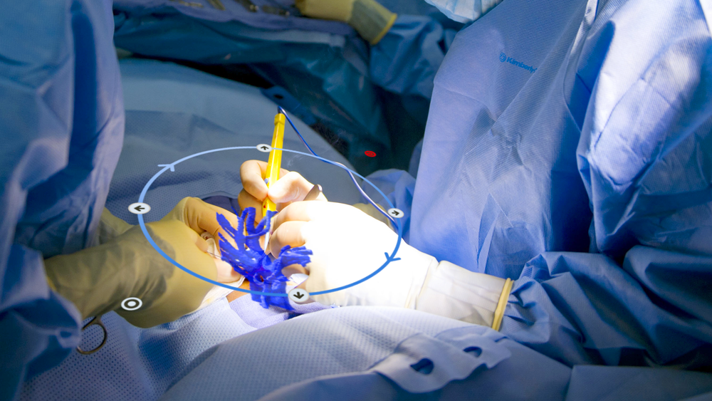 Bruk av hololens og et presist plassert hologram skal gjøre det enklere for kirurgene å komme direkte til karavganger uten å måtte lete etter dem. Det vil gi kortere operasjonstid, mindre blodtap, færre komplikasjoner – og generelt bedre og mer personalisert kirurgi.
