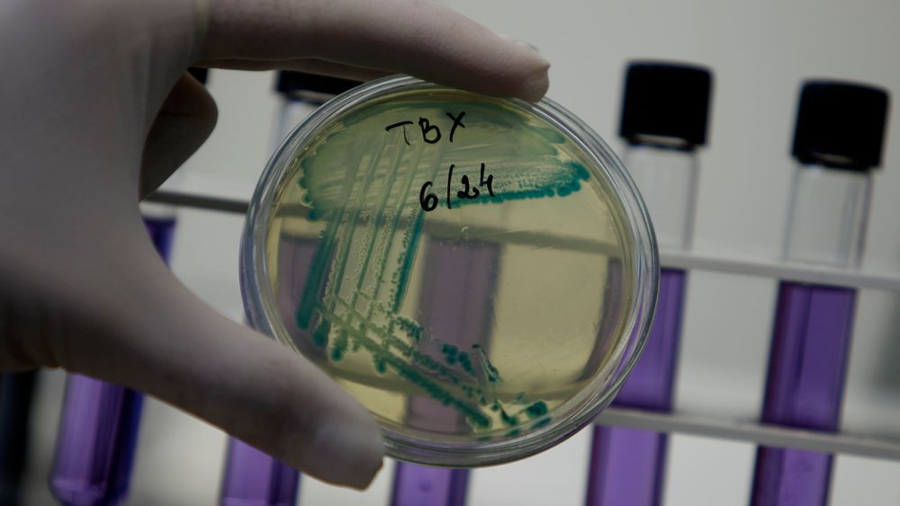 En petriskål med fremdyrkede E.coli-bakterier.