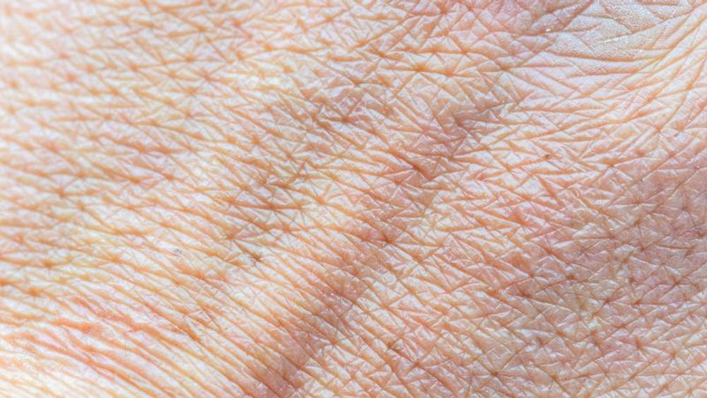 På Syddansk Universitet (SDU) har en gruppe forskere nettopp fått bevilget 15 millioner danske kroner til å forske på kunstig hud som medisinbransjen kan teste på.