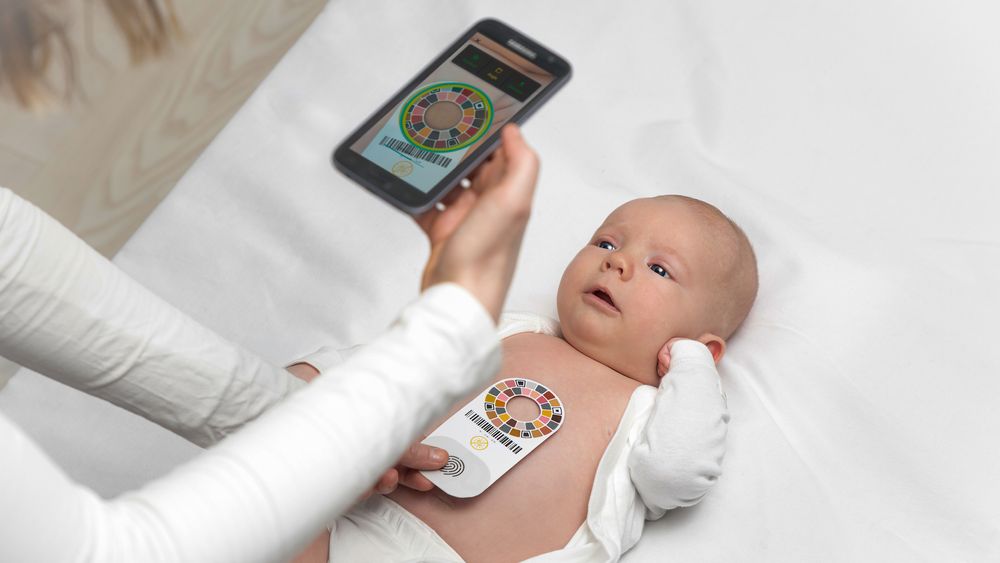 Enkelt: En billig mobiltelefon og en kalibreringsplate er alt som trengs for å avsløre gulsott hos nyfødte.