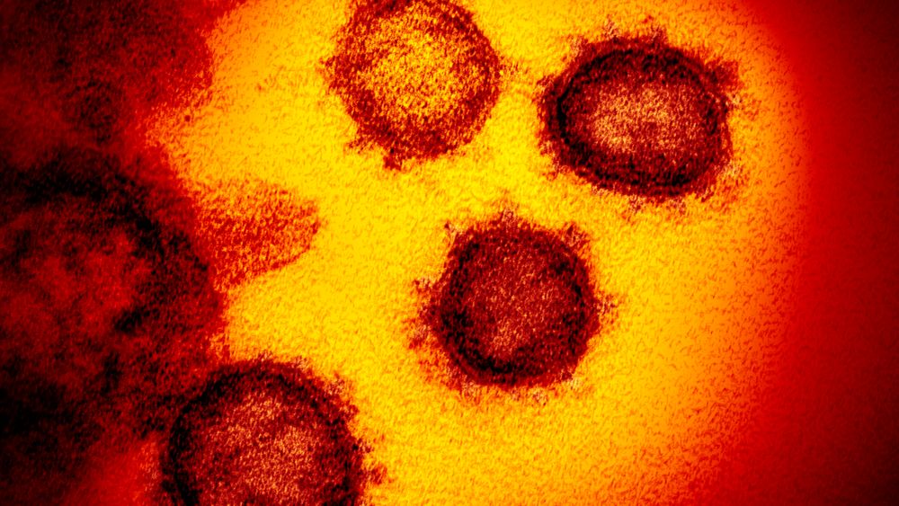 Britiske myndigheter har på rekordtid fått i gang klinisk testing av seks medisiner mot koronavirus. Først ut er medisinen Bemcentinib fra Bergenbio i Norge.