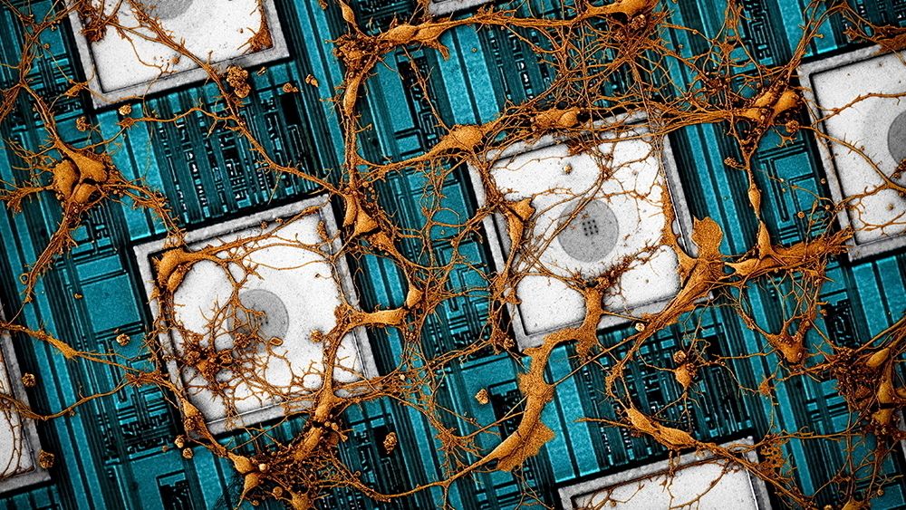 Samsung og et team av Harvard-forskere vil bruke hjernestrukturen til å lage avanserte AI-brikker.