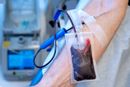 Helsedepartementet i Storbritannia ber folket om bloddonasjoner. Et hackerangrep har satt kjepper i hjulene for mye av den daglige sykehusdriften på flere av London-sykehusene.