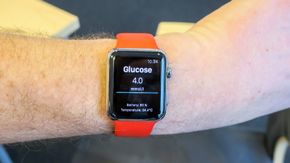 Rett pa Apple Watch: De som vil ha en smartklokke kan få verdiene fra sensoren rett inn på klokka over Bluetooth. <i>Foto: orv</i>