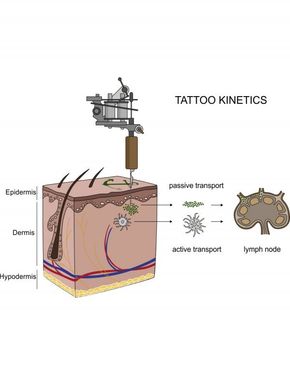 Grafikken viser hvordan tatoveringspartikler fra huden sprer seg til lymfekjertlene. Ved injeksjon av tatoveringsblekk kan partikler enten passivt transporteres via blod og lymfevæsker, eller fagocytiseres («innkapsles») av immunceller og deretter deponeres i regionale lymfeknuter. Partiklene akkumuleres i lymfekjertlene. <i>Illustrasjon:  Christian Seim</i>