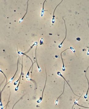 Forskere jobber med å lage både sædceller og eggceller i laboratoriet. Det kan føre til endringer i behovet for donerte celler. <i>Foto:  OUS</i>