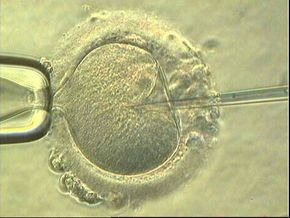 En sædcelle dyttes inn i en eggcelle ved hjelp av en hul glassnål. Metoden kalles mikroinjeksjon. <i>Foto:  OUS</i>