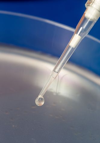 I dråpen på pipetten flyter et molekylært verktøy for genredigering kalt Crispr-Cas9. I dette tilfellet er det programmert til å endre DNA-et til celler i petriskåla hentet fra fettsuging. (Foto: Anne Sidsel Herdlevær/UiB)