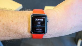 Rett pa Apple Watch: De som vil ha en smartklokke kan få verdiene fra sensoren rett inn på klokka over Bluetooth. Foto: orv
