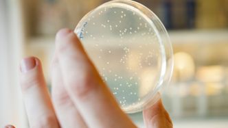 Her ser vi kolonier av bakterien E. coli, som brukes til produksjon av mange terapeutiske proteiner. Foto: Håvard Egge