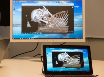 Her får vi en demonstrasjon av hvordan man kan jobbe med en 3D-modell basert på MR-bilder. Grafikkprosesseringen foregår i en virtuell maskin, mens kun skjermbildet streames over til brukere som kan sitte hvor som helst i verden. . Foto: Kurt Lekanger, digi.no