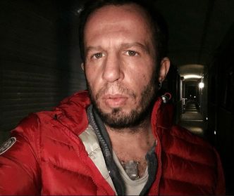 To små metallstenger festes i brystet til brukeren, som en piercing. Når huden har grodd sammen igjen – gjerne etter en måned eller to – monteres den silikonbelagte North Sense-brikken til implantatet. Foto: Cyborg Nest