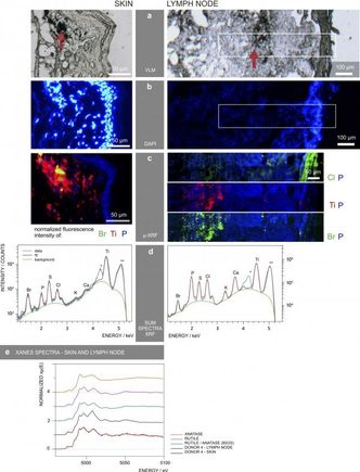 Ved hjelp av røntgen-fluorescensmålinger har man identifisert og lokalisert fargepartikkel-elementer i huden og lymfekjertlene. Forsøket er utført ved hjelp av to avdøde, tatoverte donorer og to avdøde donorer uten tatovering.. Illustrasjon:  European Synchrotron Radiation Facility
