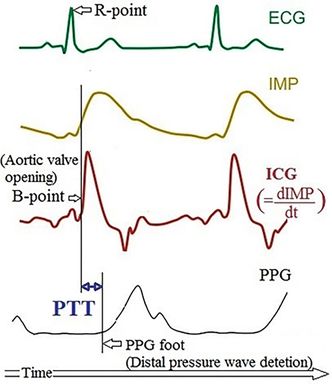 Ved å måle hjertedata med tre prinsipper; EKG, impedans og optisk kan man få frem en PPG-kurve, som sammen med gode algorimer og kalibreringsdata kan produsere blodtrykkskurver av. Foto:  Sintef
