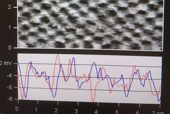De færreste av oss kan lese av resultatene fra mikroskopene. Men dette er altså til hjelp. Foto: Dennis Meier, NTNU