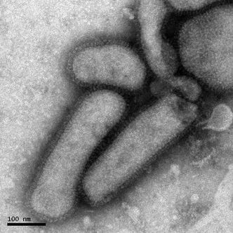 I år er det A (H1) virus som er det dominerende. Bildet viser viruspartikler nært beslektet A (H1) fra celledyrket pasientmateriale. Foto: Kjell-Olof Hedlund / Smittskyddsinstitutet