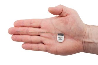 Implantatet er på størrelse med et kronestykke, og settes inn i med et lite snitt bak øret. Foto: UNEEG medical