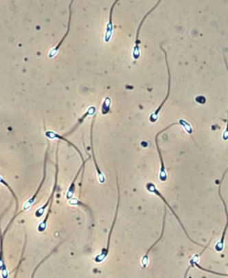 Forskere jobber med å lage både sædceller og eggceller i laboratoriet. Det kan føre til endringer i behovet for donerte celler. Foto: OUS