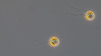Slik ser de ut, Chrysochromulina-algene som har tatt livet av så mange laks denne våren. Foto:  Bente Edvardsen
