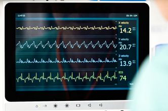 X, Y og Z-bevegelser: Akselerometeret måler bevegelse i tre retninger. Vegghastigheten til ventrikkelen er et kjent mål for hjertefunksjon som benyttes ved bruk av ultralyd og vevsdoppler. Foto: Cardiaccs