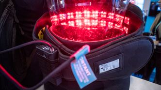 Laserdispril: Røde laserdioder kan brukes til så mangt. For eksempel til å dempe smerte i ryggen, Foto: Odd Richard Valmot