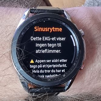 All clear: Ikke noe hjerteflimmer denne gangen. På EKG tenker vi klokka viser et resultat som er til å stole på Foto: Odd Richard Valmot
