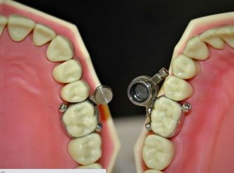   Foto:  Otago University